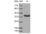 Recombinant Human EGF Protein (Fc Tag)(Active)