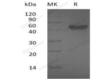 Recombinant Human IL-12 p40/IL-12B Protein