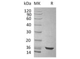 Recombinant Human IL-10/Interleukin-10 Protein