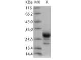 Recombinant Human PGD2 Synthase/PTGDS Protein (His Tag)