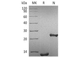 Recombinant Human TGFB1/TGF-beta 1 Protein (Active)