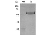 Recombinant Human EphA2 Protein (His Tag)(Active)