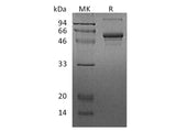 Recombinant Human CSNK1G2 Protein (His Tag)