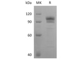 Recombinant Human EphB2 Protein (Fc Tag)(Active)