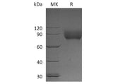 Recombinant Human CSF1R/CD115 Protein (aa 20-517, His Tag)(Active)