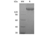 Recombinant Human VEGFR2/Flk-1/KDR Protein (Fc Tag)