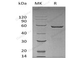 Recombinant Human 14-3-3 epsilon/YWHAE Protein (GST Tag)