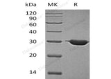 Recombinant Human BDH2 Protein (His Tag)