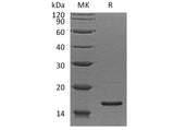 Recombinant Human RPS19 Protein