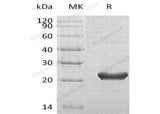 Recombinant Human RPS7 Protein (His Tag)