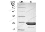 Recombinant Human 4-1BBL/TNFSF9 Protein (His Tag)(Active)