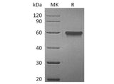 Recombinant Human 4-1BB/TNFRSF9 Protein (Fc Tag)(Active)