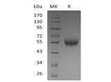 Recombinant Human 4-1BB/TNFRSF9 Protein (Fc & His Tag)(Active)