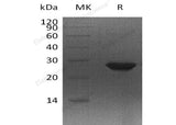 Recombinant Human MTHFS Protein (His Tag)