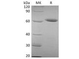 Recombinant Human CD73/NT5E Protein (His Tag)(Active)