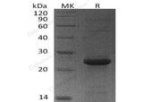 Recombinant Human MGMT Protein (His Tag)