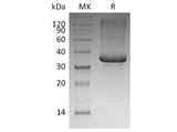 Recombinant Human SP-10/ACRV1 Protein (His Tag)