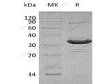 Recombinant Human ATF1 Protein (His Tag)