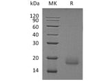 Recombinant Human ALK-2/ACVR1 Protein (Human Cells, His Tag)