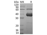 Recombinant Human Activin RIIA/ACVR2A Protein (Fc & His Tag)(Active)