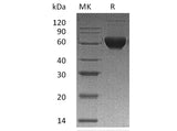 Recombinant Human Activin Receptor 2B/ACVR2B Protein (Fc & His Tag)(Active)