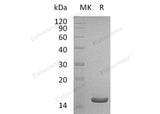 Recombinant Human THEM2/ACOT13 Protein (His Tag)