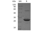 Recombinant Human LYPLA1 Protein (His Tag)