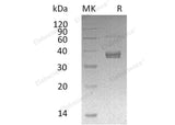 Recombinant Human ADAMDEC1 Protein (His Tag)