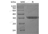 Recombinant Human Adiponectin/ADIPOQ Protein (His Tag)