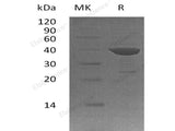 Recombinant Human ADPRH/ARH1 Protein (His Tag)