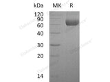 Recombinant Human TMPRSS11B Protein (His Tag)