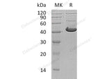 Recombinant Human ADH7 Protein (His Tag)