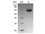 Recombinant Human ALDH1A2 Protein (His Tag) 