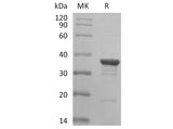 Recombinant Human AKR1C2 Protein