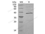 Recombinant Human AKR1C3 Protein (His Tag) 