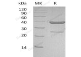 Recombinant Human AKR1C4 Protein (His Tag)