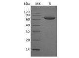 Recombinant Human Alkaline Phosphatase/ALPL Protein (His Tag)