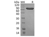 Recombinant Human Placental Alkaline Phosphatase 1/ALPP Protein (His Tag)