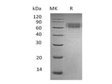 Recombinant Human Ameloblastin/AMBN Protein (His Tag)