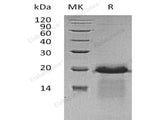 Recombinant Human APBA3 Protein (His Tag)