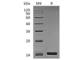 Recombinant Human Angiogenin/ANG Protein