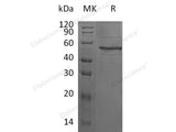 Recombinant Human ANGPTL8/β-trophin Protein (Fc Tag)