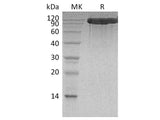 Recombinant Human ACE2 Protein (His Tag)