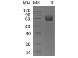 Recombinant Human Angiotensinogen/AGT Protein (His Tag)