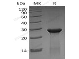 Recombinant Human ASB13 Protein (His Tag)