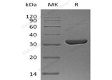 Recombinant Human Annexin A10/ANXA10 Protein