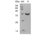 Recombinant Human Annexin A13/ANXA13 Protein