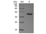 Recombinant Human Annexin A2/ANXA2 Protein