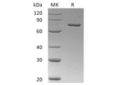 Recombinant Human Annexin A6/ANXA6 Protein (His Tag)