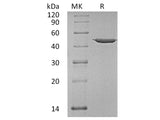 Recombinant Human Annexin A7/ANXA7 Protein